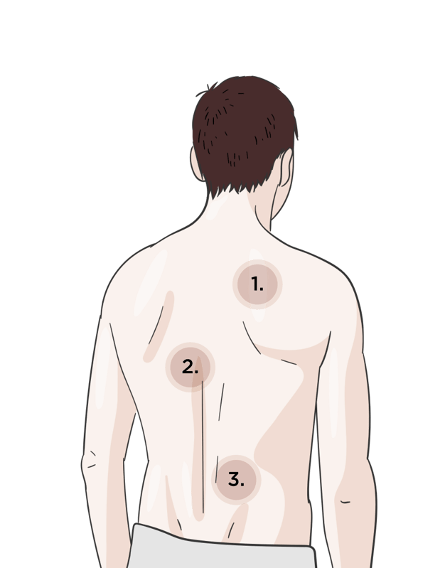 Illustration eines maennlichen Rueckens mit Nummern an den Schmerzbereichen: oberer Ruecken, mittlerer Ruecken und unterer Ruecken