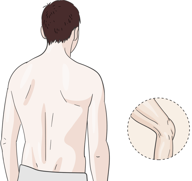 Illustration eines Mannes, zeigt welche Schmerzpunkte durch ThermaCare Wärmepflaster und Umschläge behandelt werden können