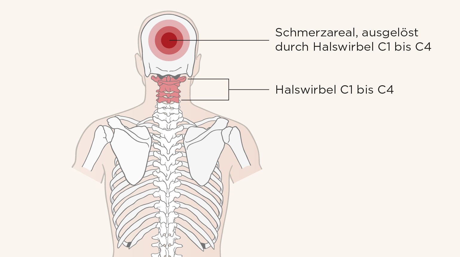 Illustration einer menschlichen Wirbelsäule, unterteilt in fünf Abschnitte mit den hervorgehobenen Halswirbeln C1 bis C4, die zur HWS gehören Illustration einer menschlichen Wirbelsäule, unterteilt in fünf Abschnitte mit den hervorgehobenen Halswirbeln C1 bis C4, die zur HWS gehören