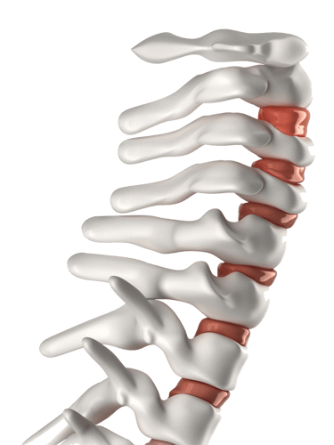 Nackenschmerzen: Ursachen und Behandlungswege