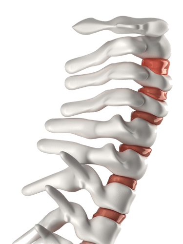 Nackenschmerzen: Ursachen, Symptome & Behandlung