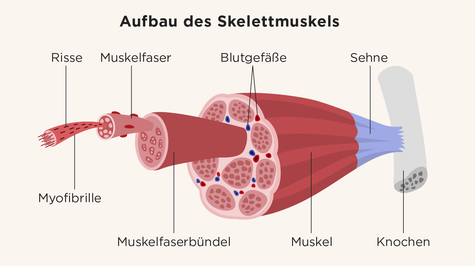 Illustration des Aufbaus des Skelettmuskels, bestehend aus Muskelfasern, Muskelfaserbündeln und Blutgefäßen. Feine Risse in den Myofibrillen zeigen Belastung durch intensives Muskeltraining.