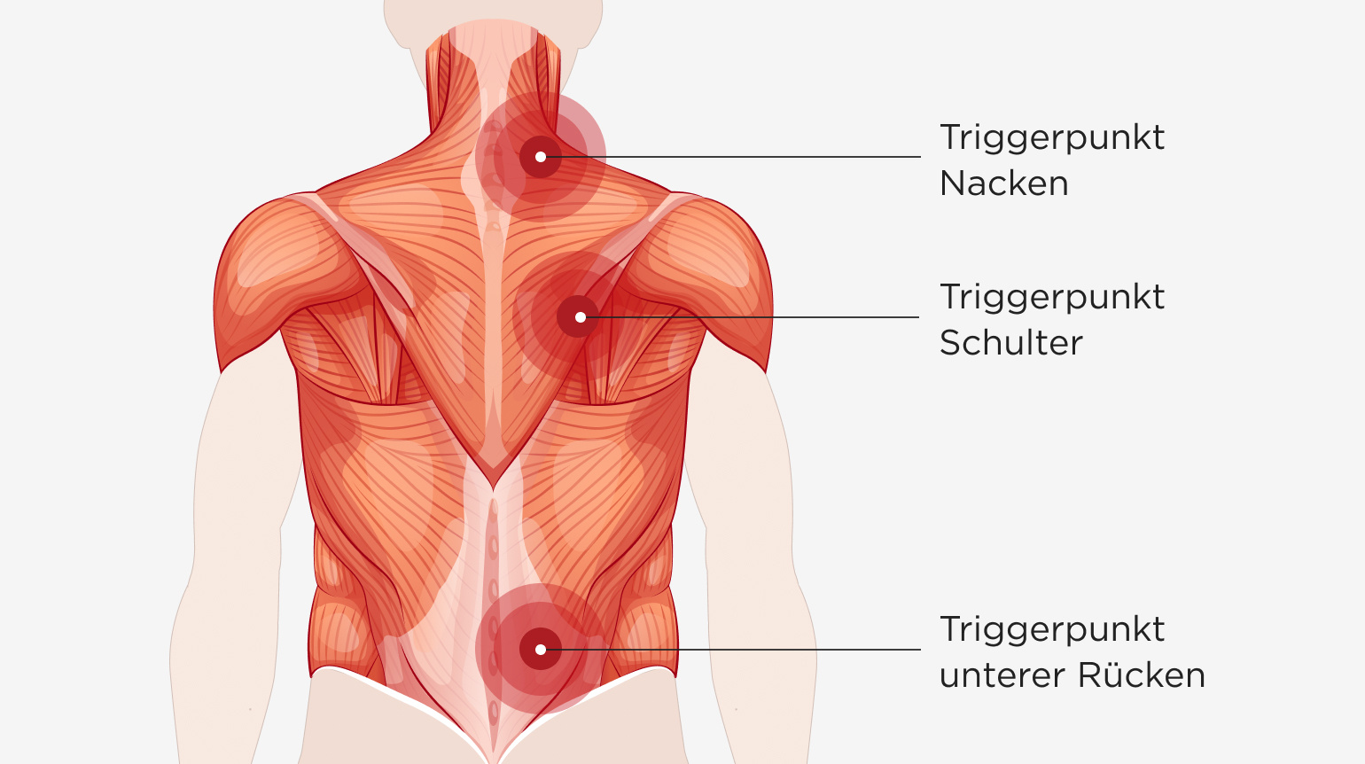 Illustration verschiedener Muskelregionen an Rücken, Hals und Schultern inklusive drei Triggerpunkten an Schulter, Nacken und unterem Rücken.