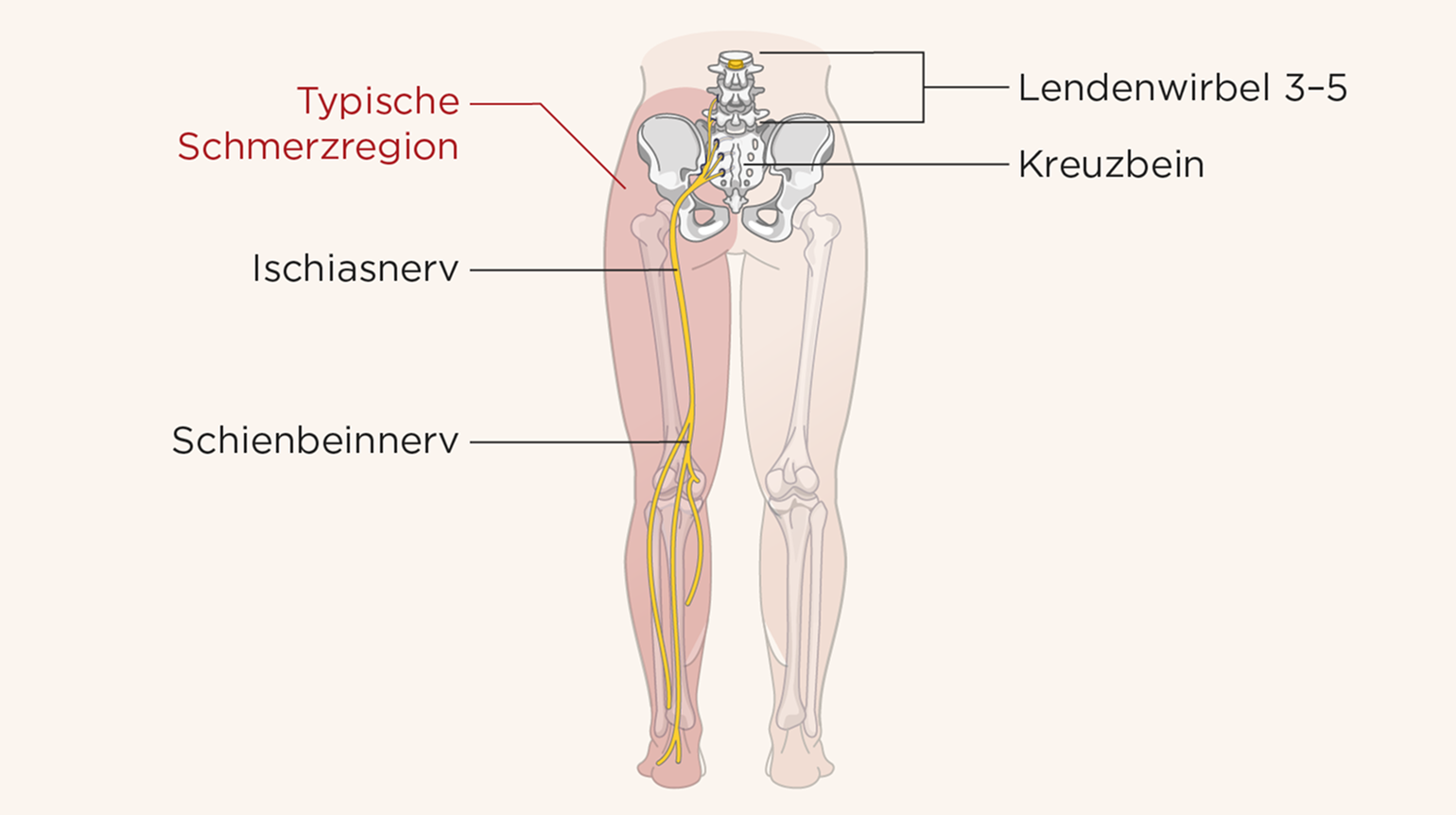 Illustration der Beine zur Veranschaulichung des Ischiasnerv Illustration der Beine zur Veranschaulichung des Ischiasnerv