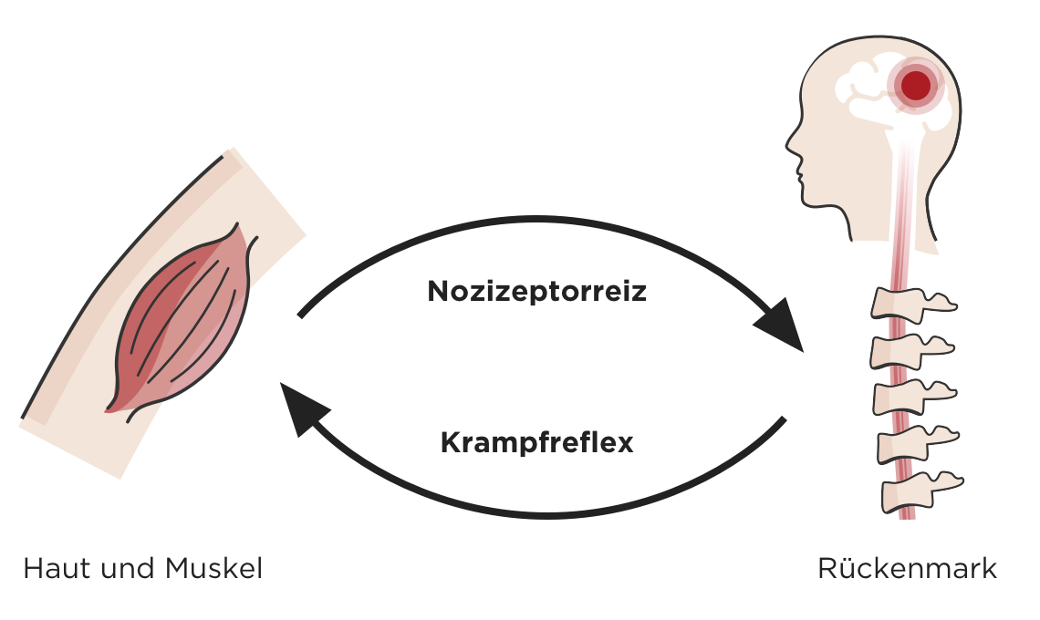 Illustration zeigt den Kreislauf eines schmerzenden Muskels, diese Information wird vom zum Rueckenmark zum Gehirn weitergeben