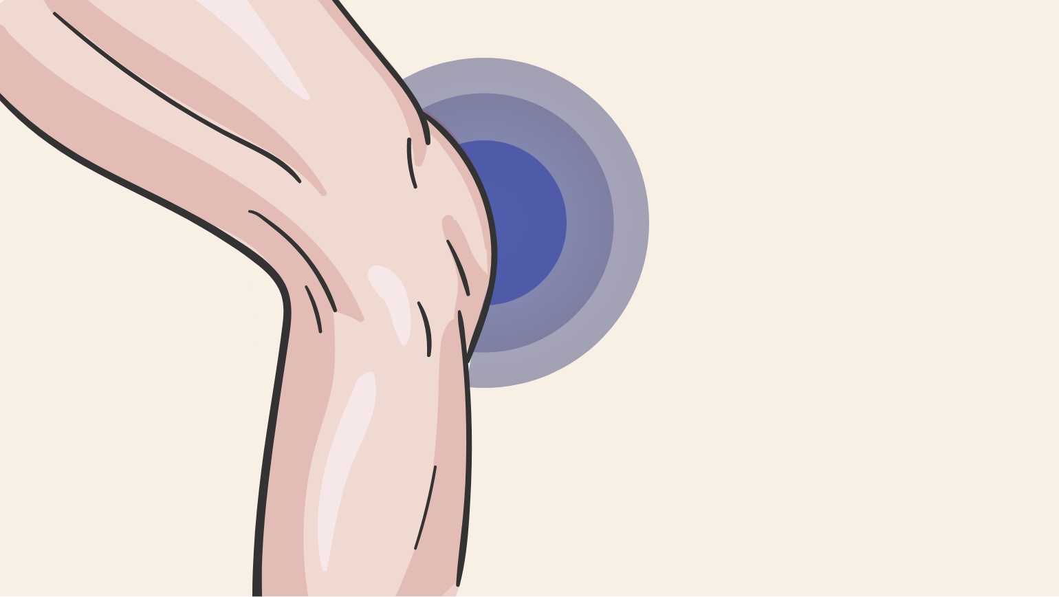 Illustration eines Beines das Knie ist mit einem blauen Punkt markiert